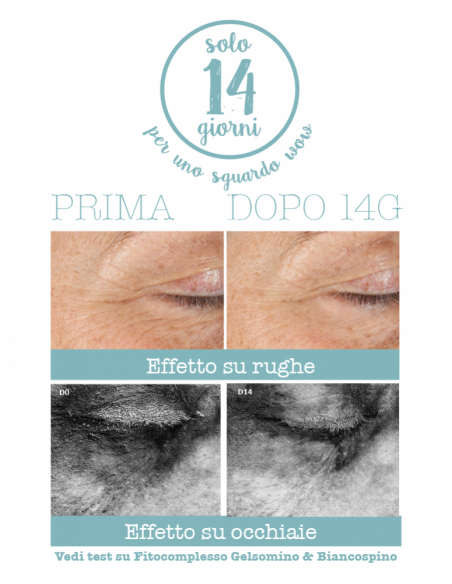 Crema Contorno Occhi 3 in 1 | La Saponaria | Wingsbeat Crema Contorno Occhi 3 in 1 | La Saponaria | Wingsbeat