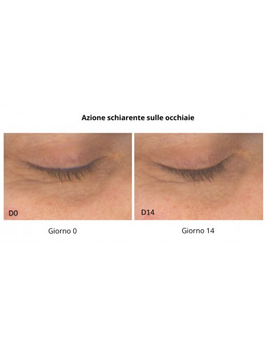 Contorno Occhi Lift & Restore | Acquista su Wingsbeat