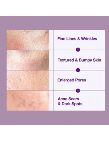 Retinol 0,3% + Niacin Renewing Serum Retinol 0,3% + Niacin Renewing Serum