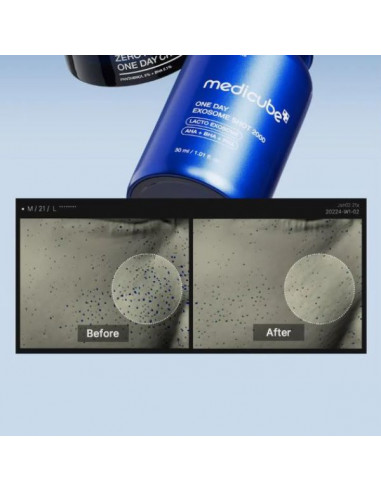 One Day Exosome Shot Pore Ampoule 2000, 30ml|Medicube|Wingsbeat